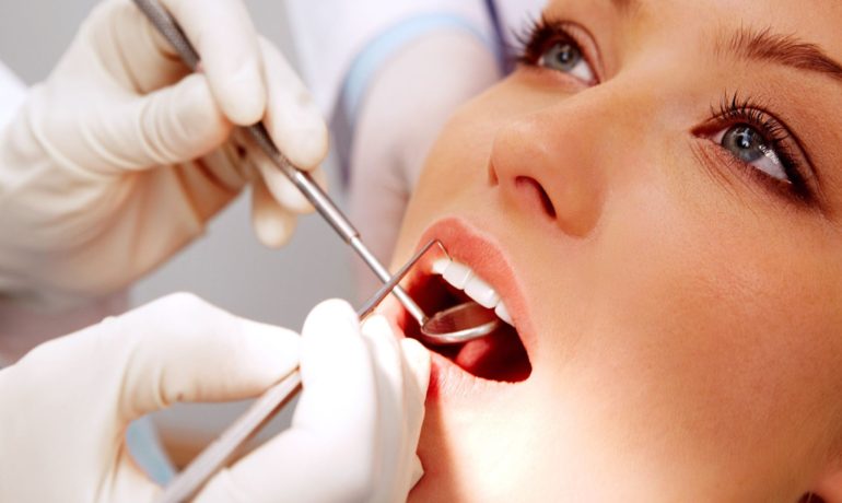 Extractia dentara