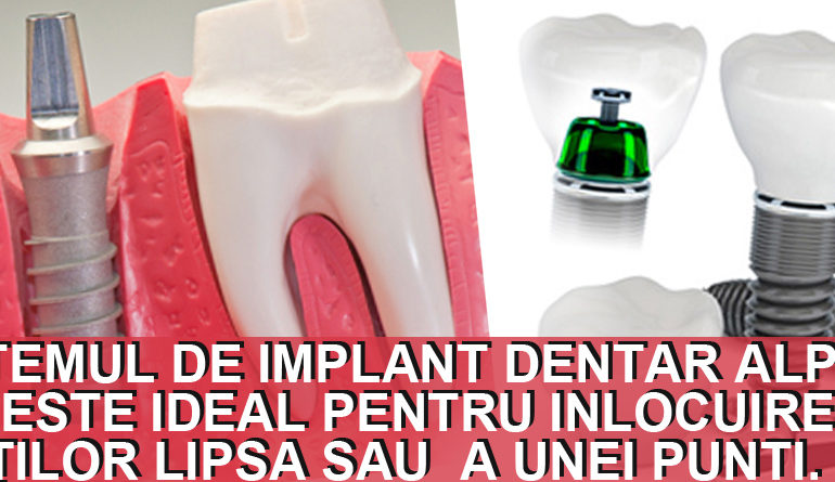 Implanturi dentare Alpha Bio